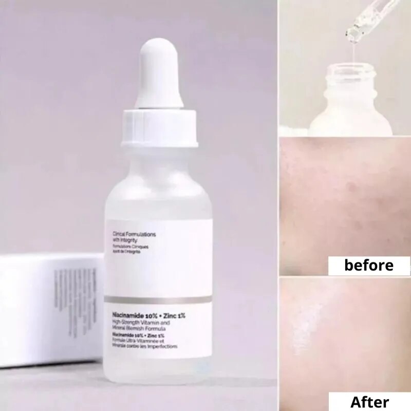 Niacinamide 10% + Zinc 1% Face Serum Original Products Oil Balance Ordinary Whitening Moisturizer Essence Hydrating Skin Care