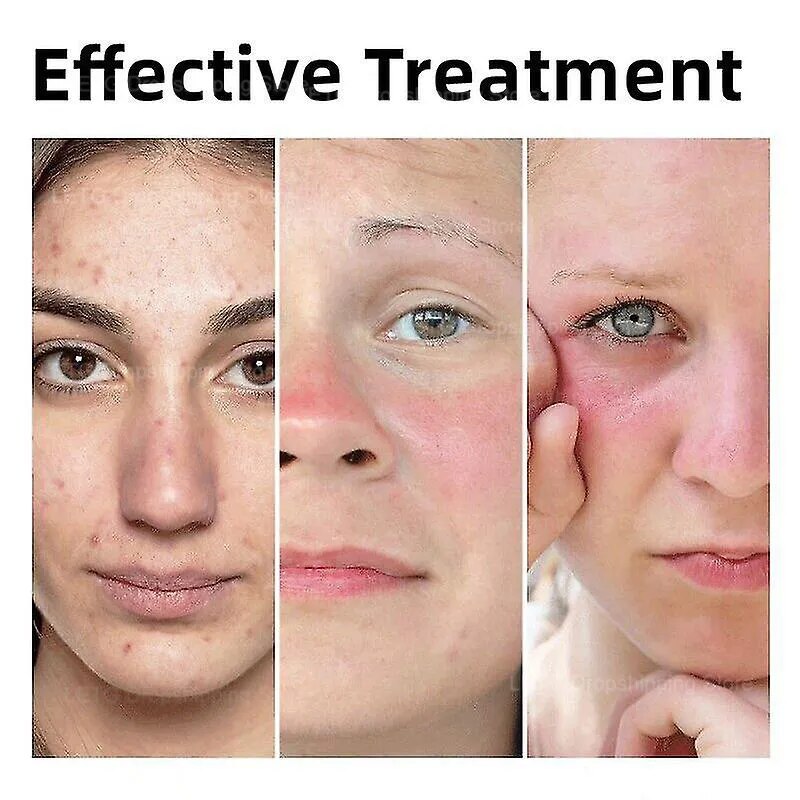 Original CeraVe Facial Essence Moisturizes Cleanser Emulsion Whitening Brightening Cream Facial Repair Product Skin Care Product