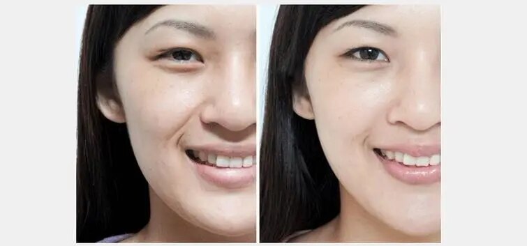 Natural germanium stone beauty bar facial skin care tools 24 k vibration beauty bar Facial ministry massager thin face beauty eq