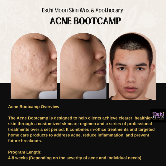 Acne Bootcamp